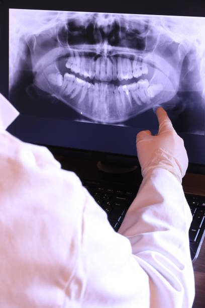 Best Emergency Treatment for Dental Infections or Abscesses in Orfordville, WI
